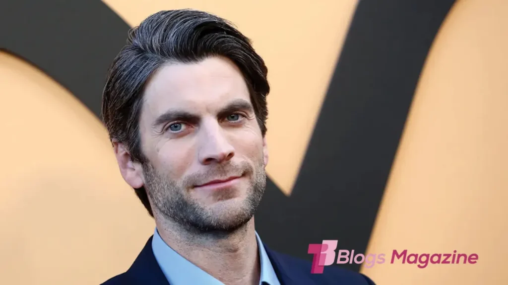 Wes Bentley Teeth
