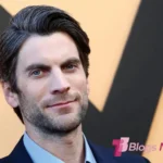 Wes Bentley Teeth